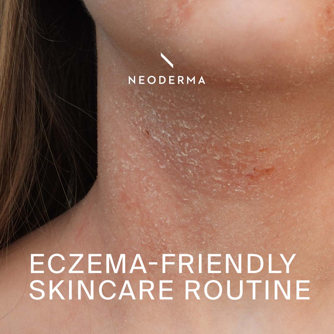 EczemaFriendly Skincare Routine NEODERMA