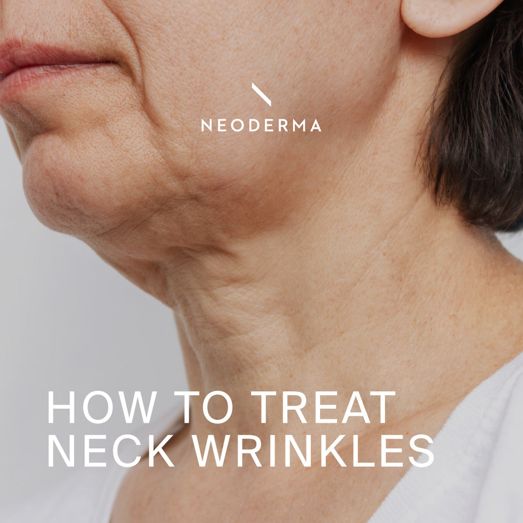 How to Treat Neck Wrinkles