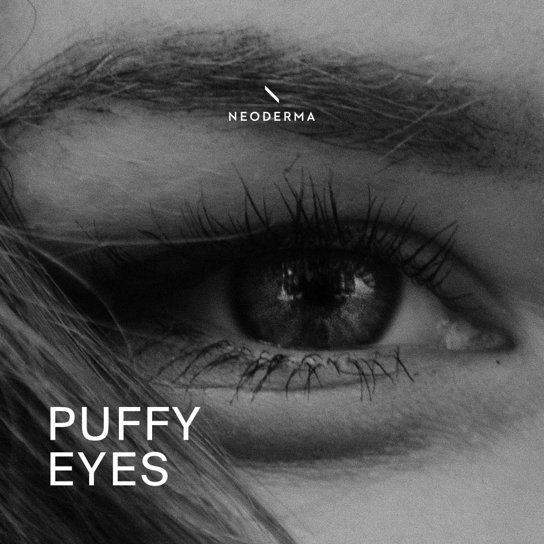 Puffy Eyes Facial Massage NEODERMA