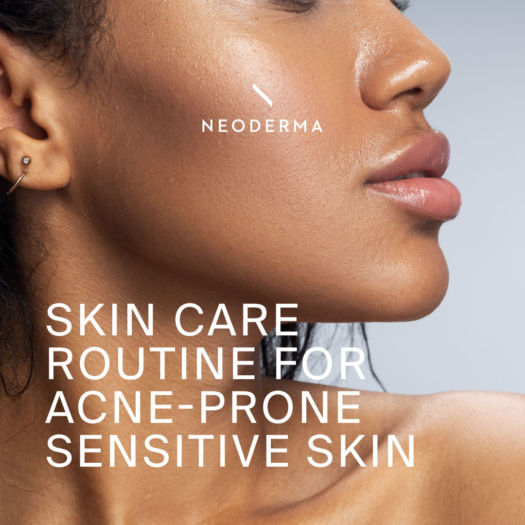 Skin Care Routine for Acne-Prone Sensitive Skin