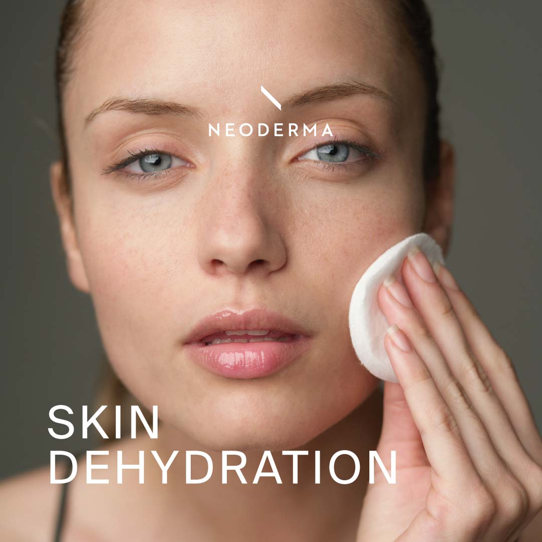 Skin Dehydration NEODERMA