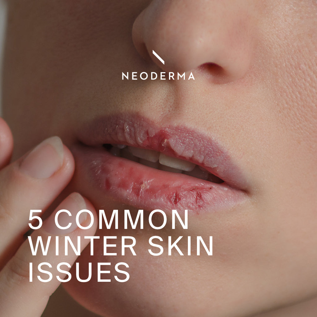 5 Common Winter Skin Issues