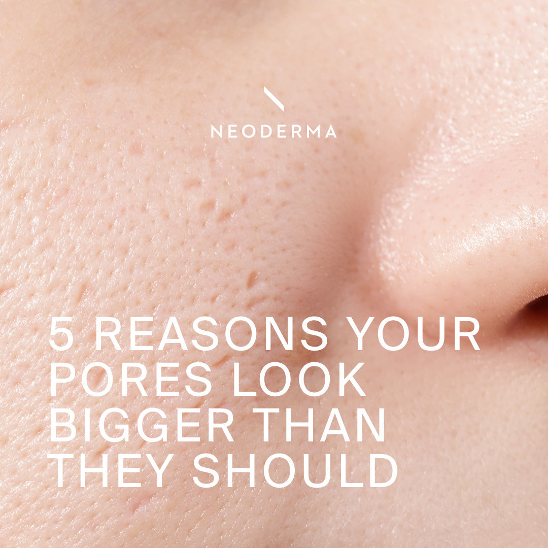 5 Reasons Your Pores Look Bigger Than They Should