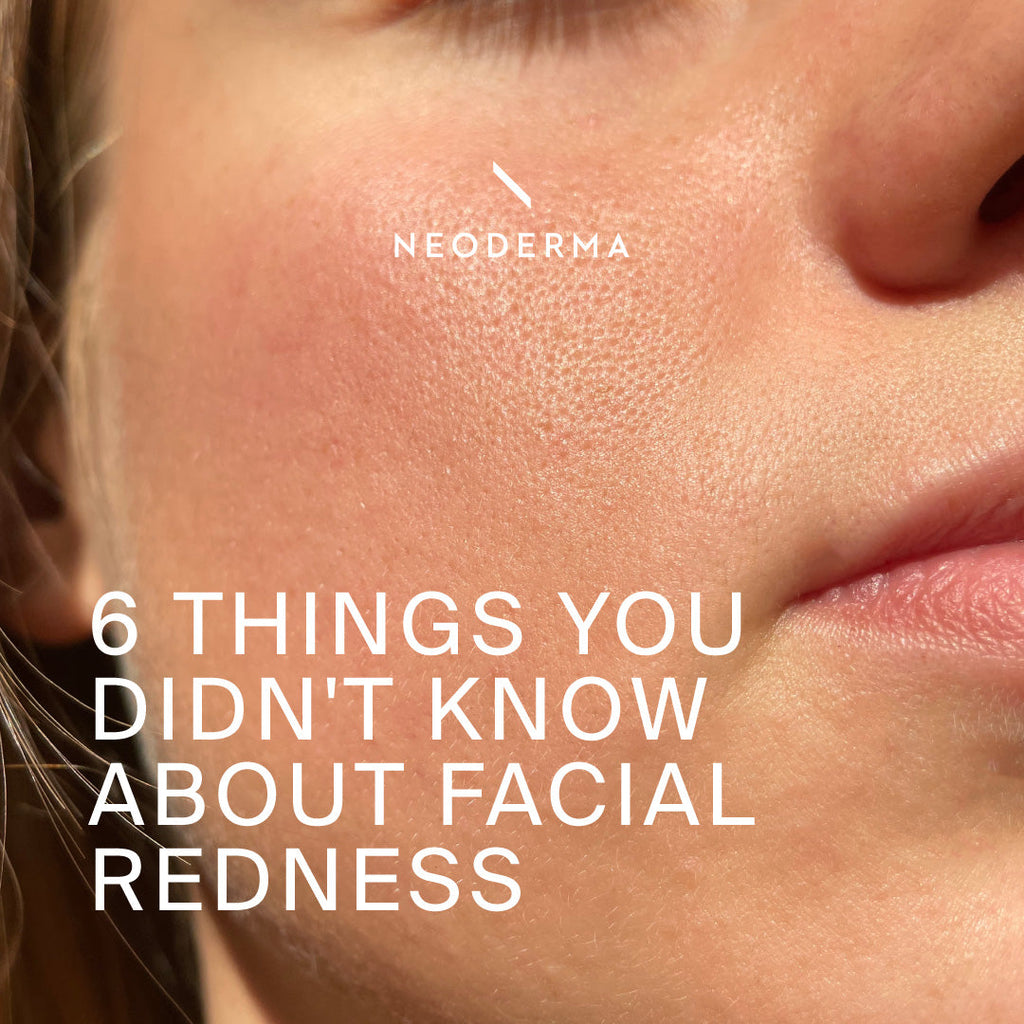 6 Things You Dind't Know About Facial Redness