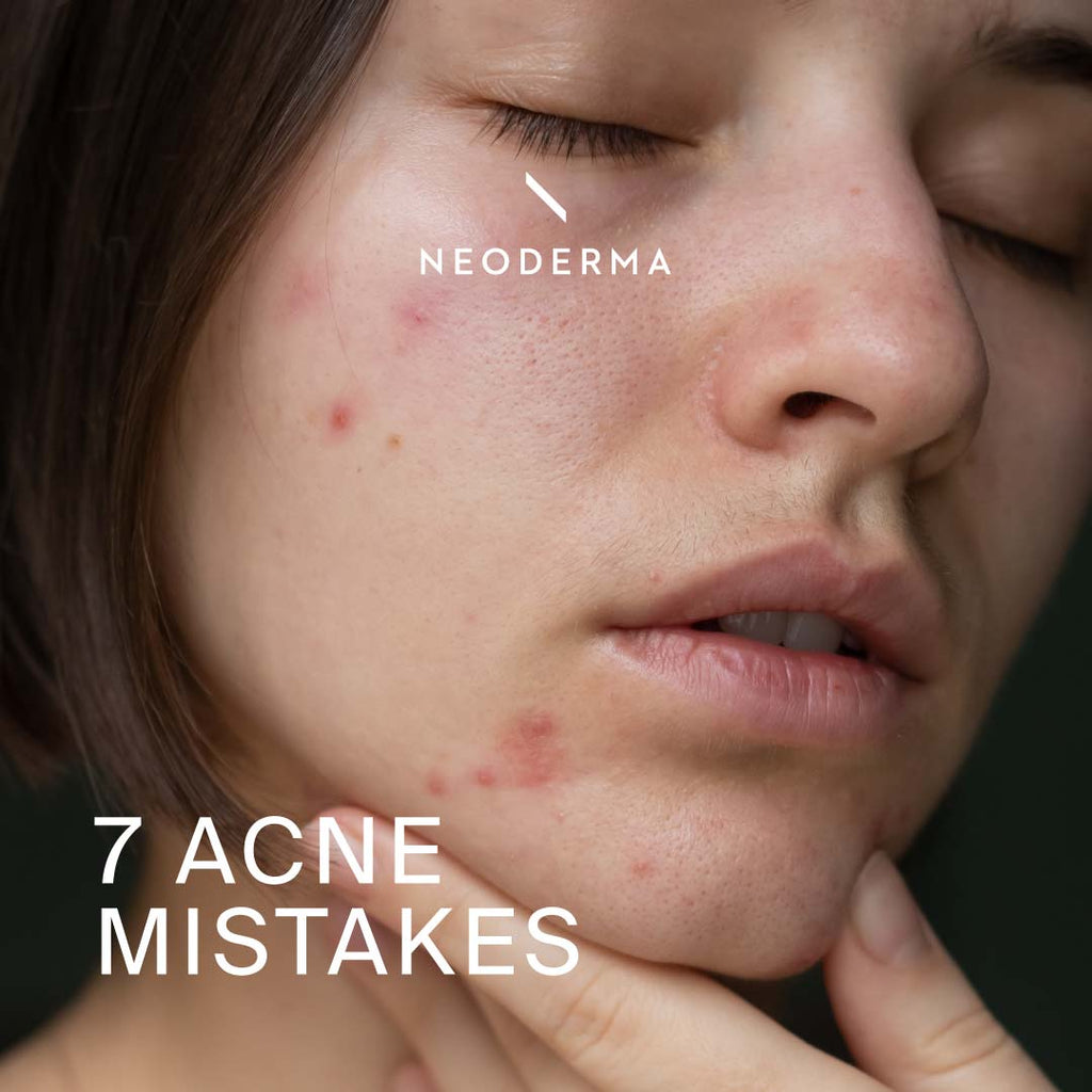 7 Acne Mistakes