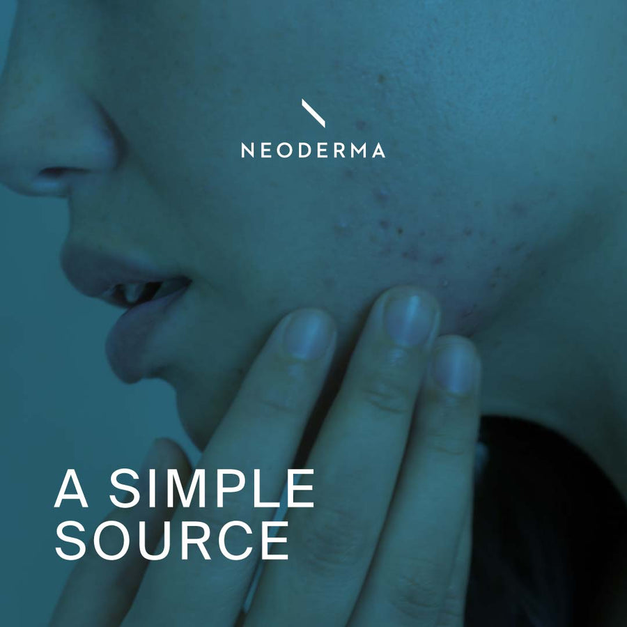 A Simple Source