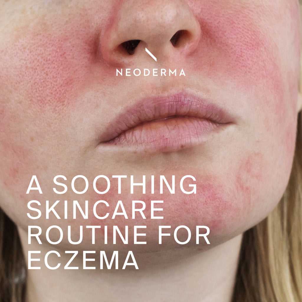 A Soothing Skincare Routine for Eczema