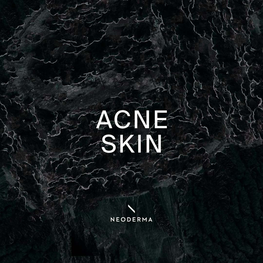 Acne Skin