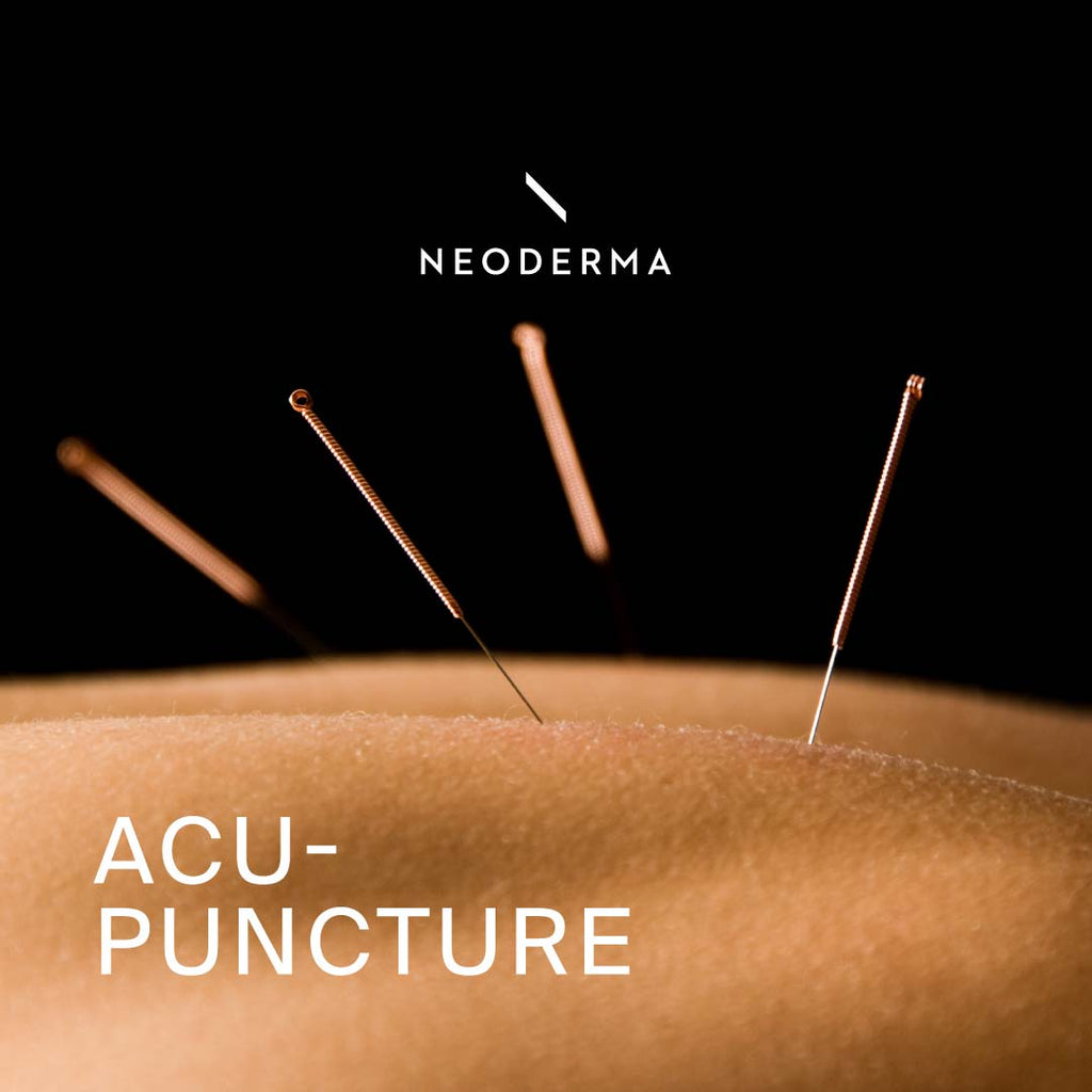 Acupuncture