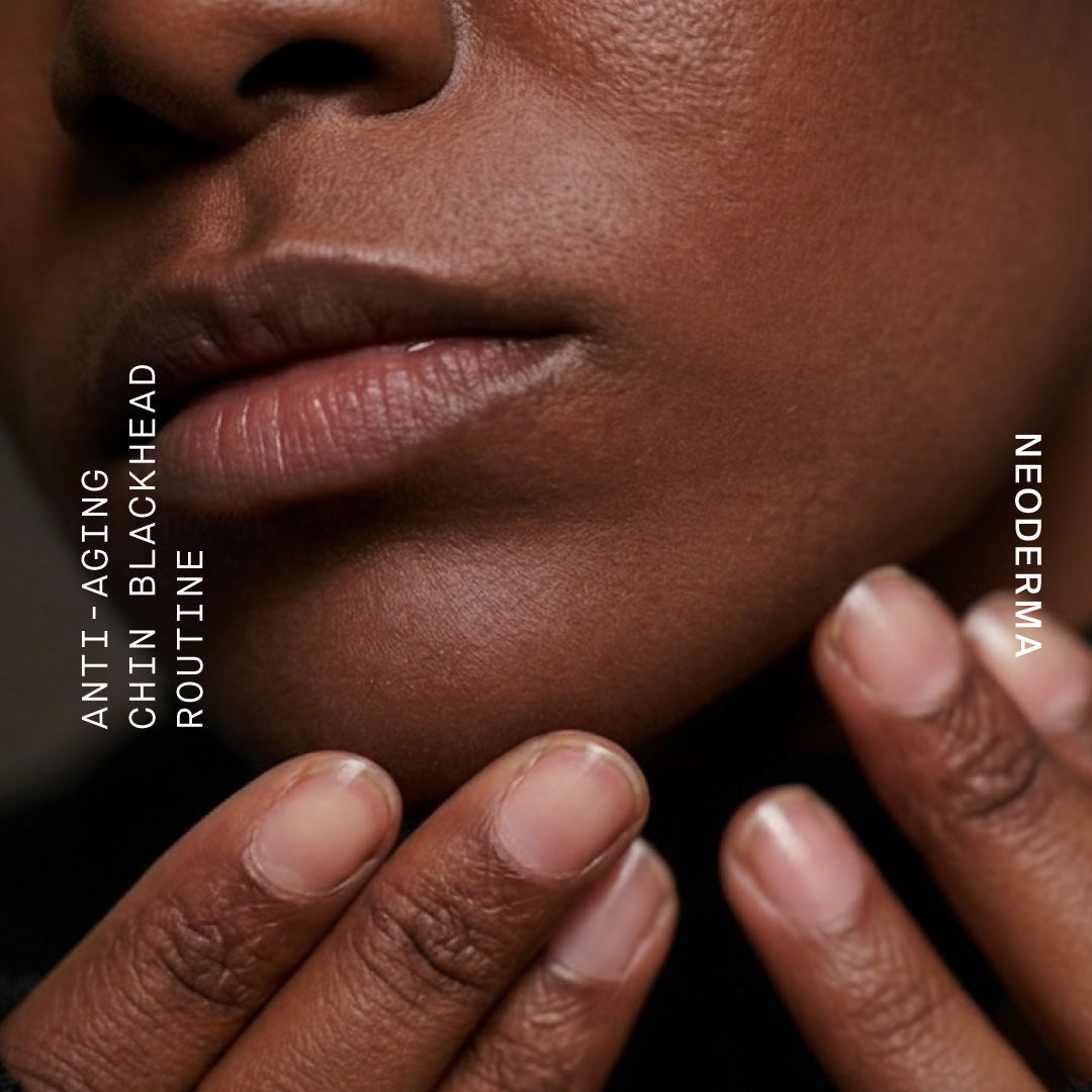 Anti-Aging Acne Skin Care: How To Get Rid Of Blackheads On Your Chin