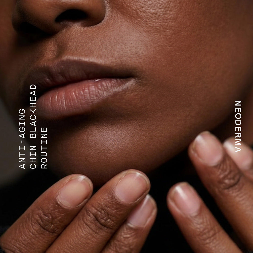Anti-Aging Acne Skin Care: How To Get Rid Of Blackheads On Your Chin