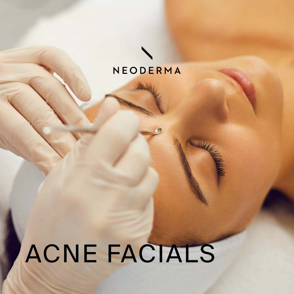 Acne Facials