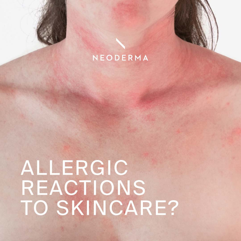 Allergic Reactions to Skincare?