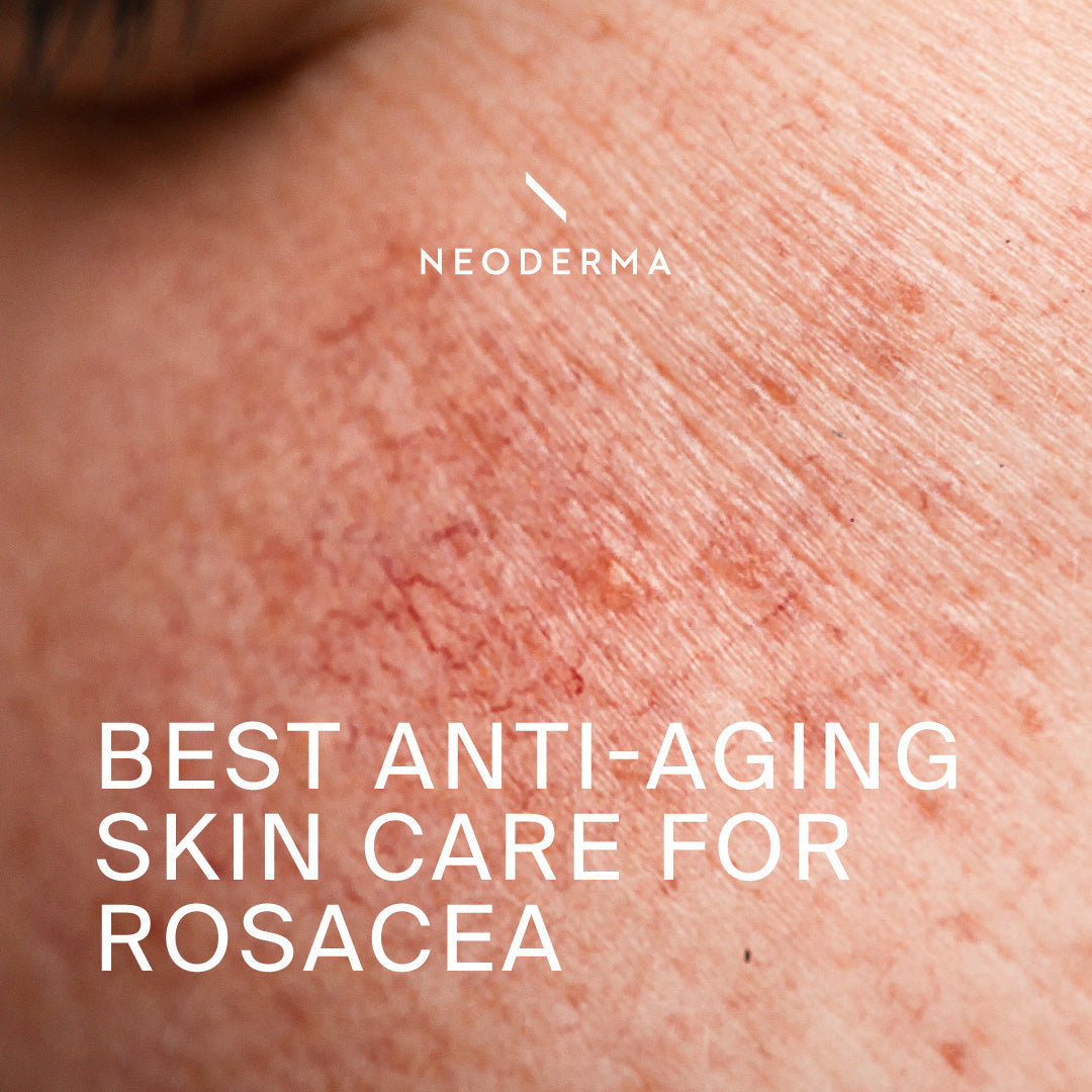 Best Anti-Aging Skin Care For Rosacea