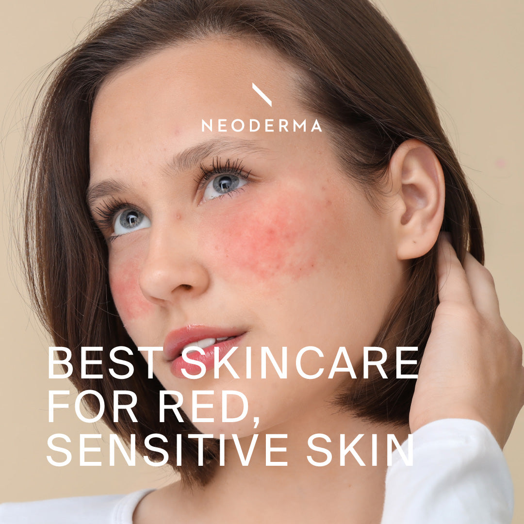 How To get Rid Of Red Skin Without Makeup: Skincare For Red, Sensitive Skin That Actually Works