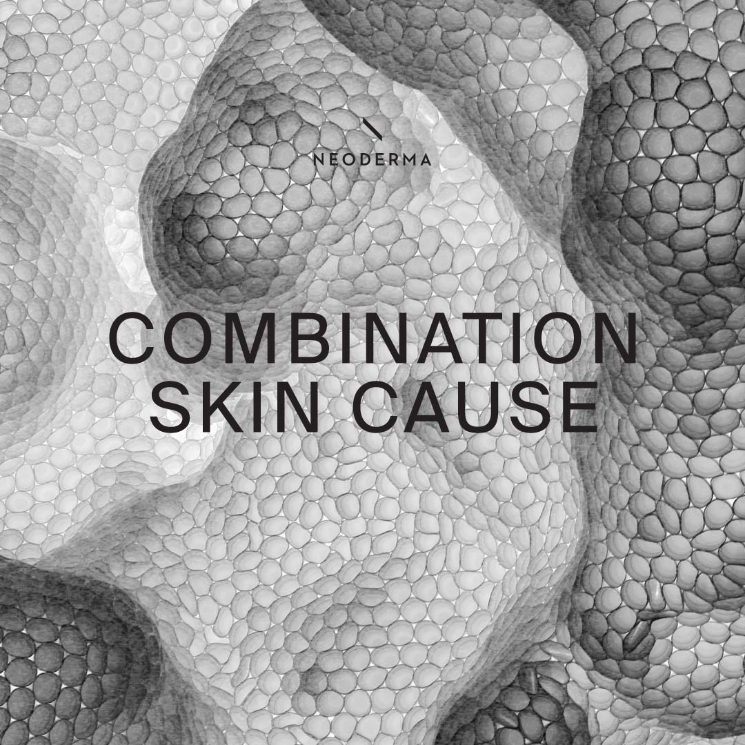 Combination Skin Cause