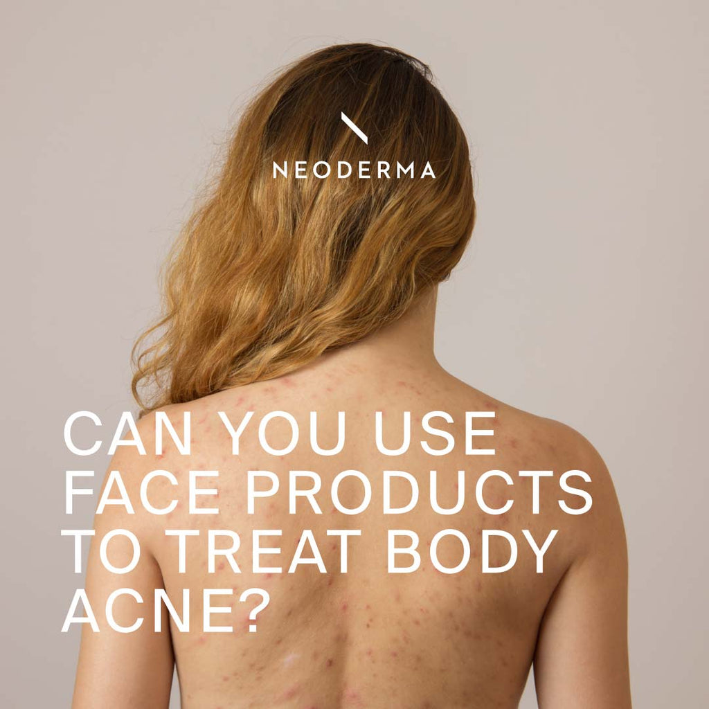 Can you Use Face products to Treat Body Acne?