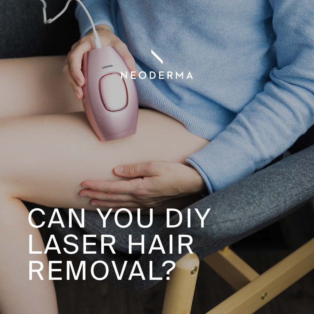 Can You DIY Laser Hair Removal?