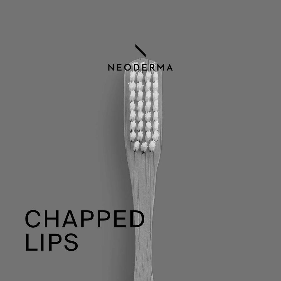 Chapped Lips