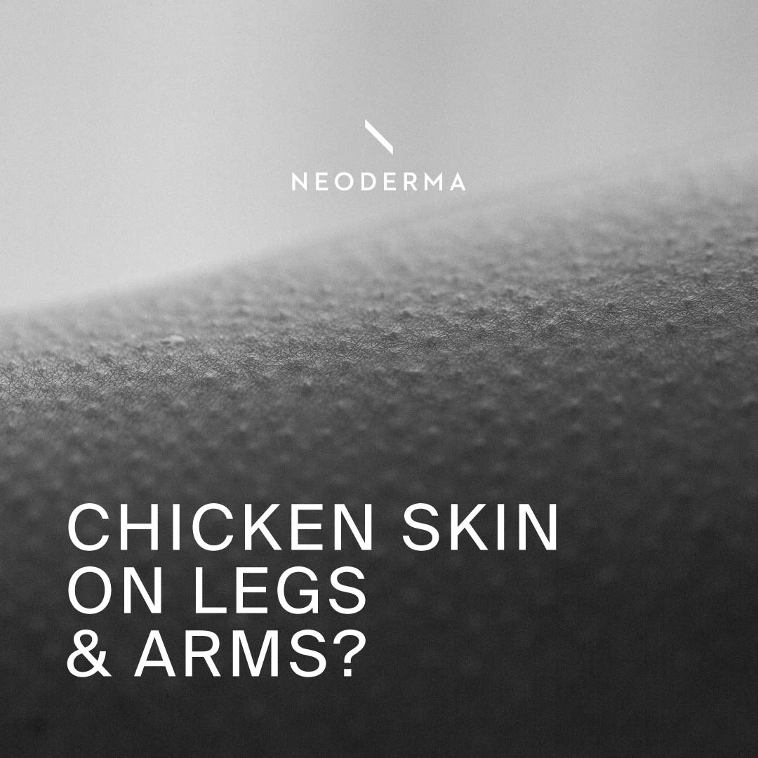 Chicken Skin on Legs & Arms?