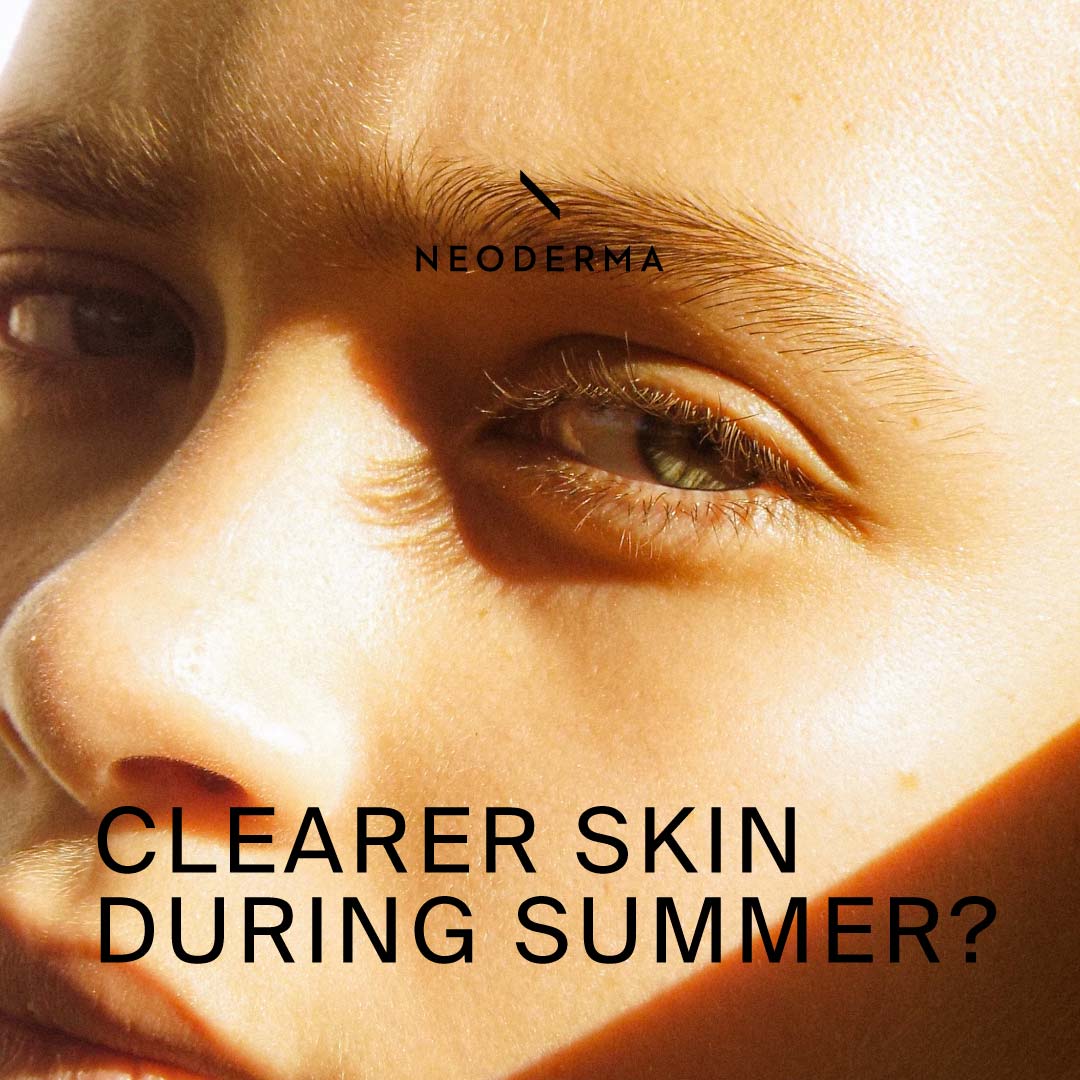Clearer Skin During Summer