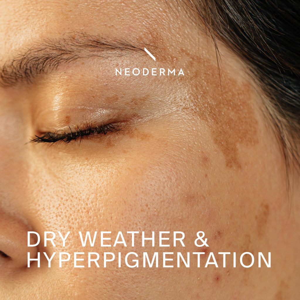Dry Weather and Hyperpigmentation
