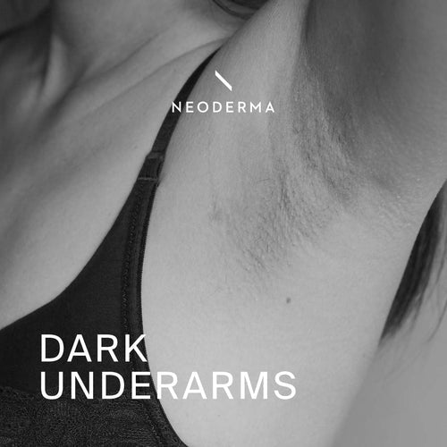 Dark Underarms