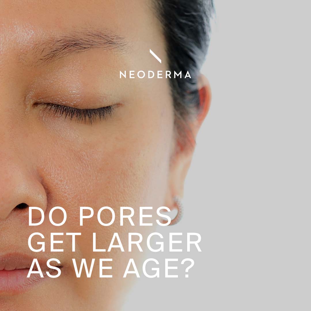 Do Pores Get Larger As We Age?