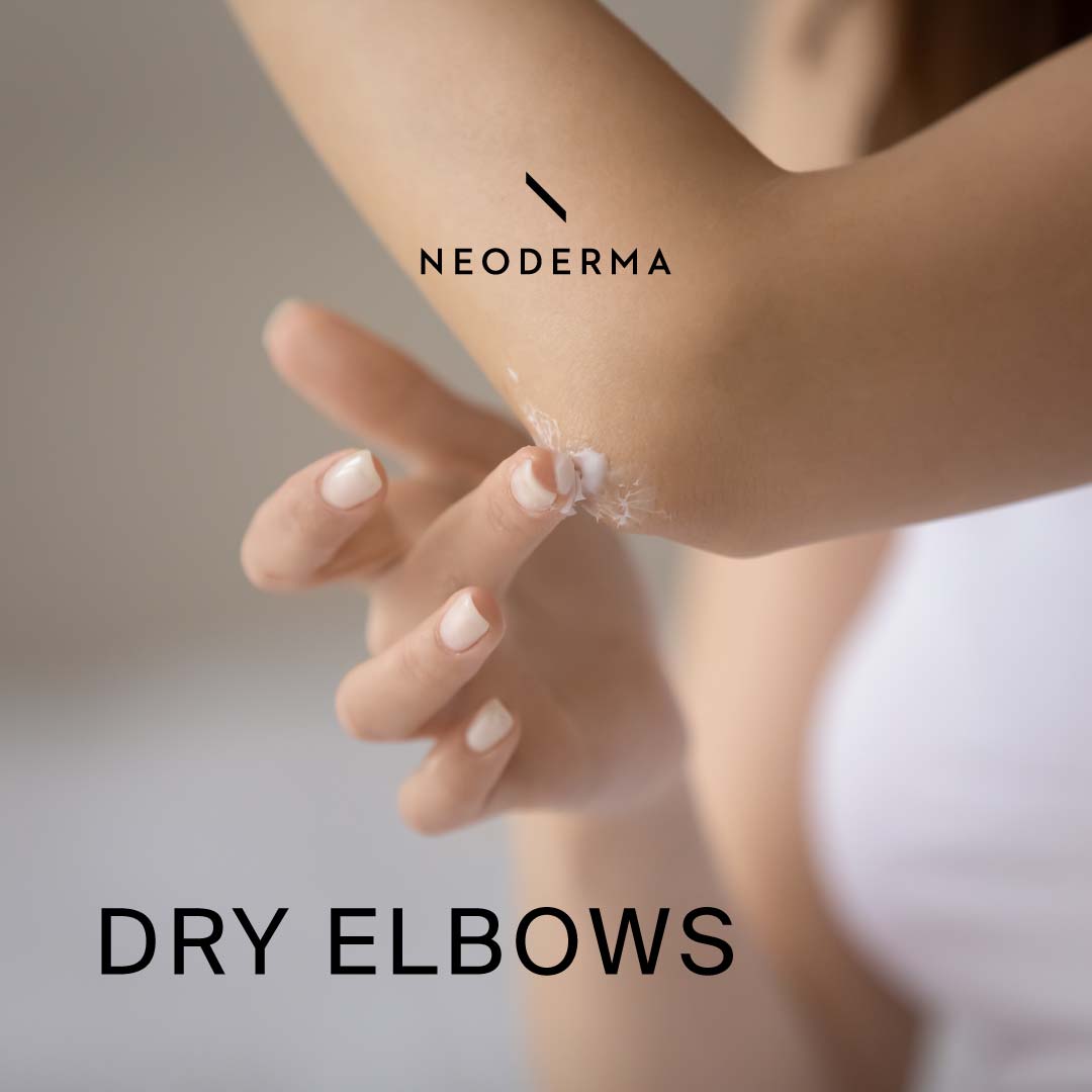 Dry Elbows