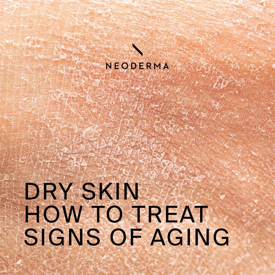 Dry Skin How To Treat Signs Of Aging Neoderma