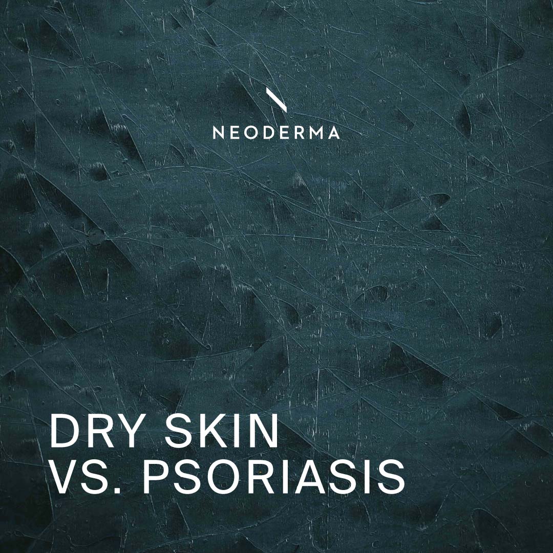 Dry Skin Vs. Psoriasis