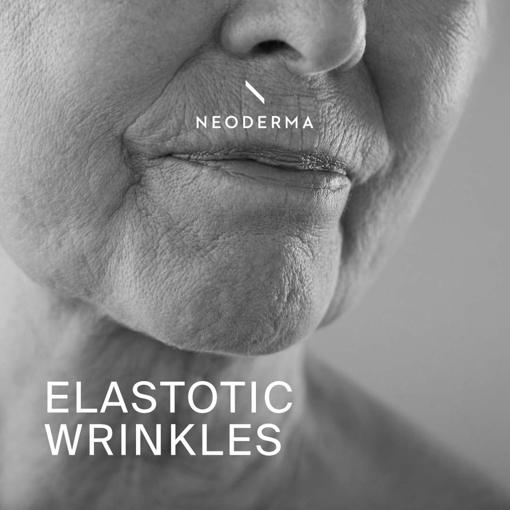 Elastotic Wrinkles
