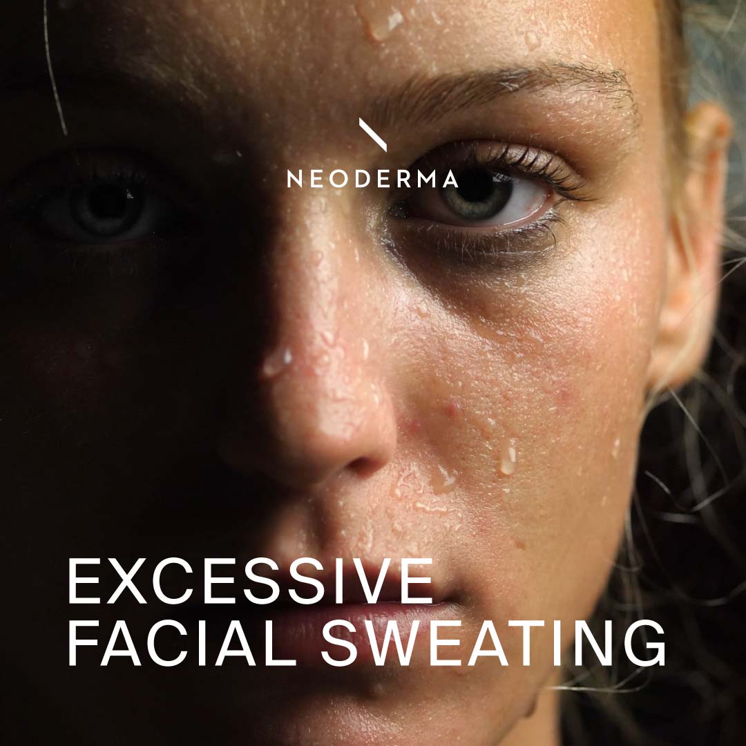 Excessive Facial Sweating – NEODERMA
