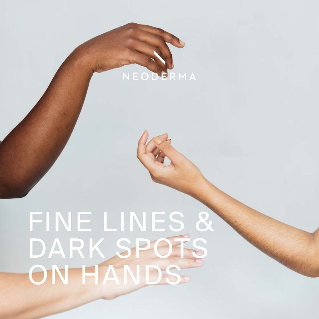 Fine Lines & Dark Spots On Hands