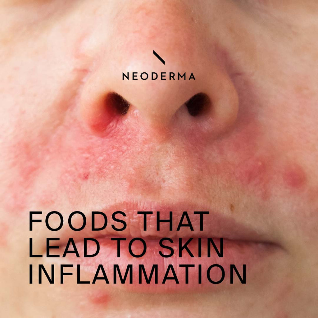 Food That Lead to Skin Inflammation