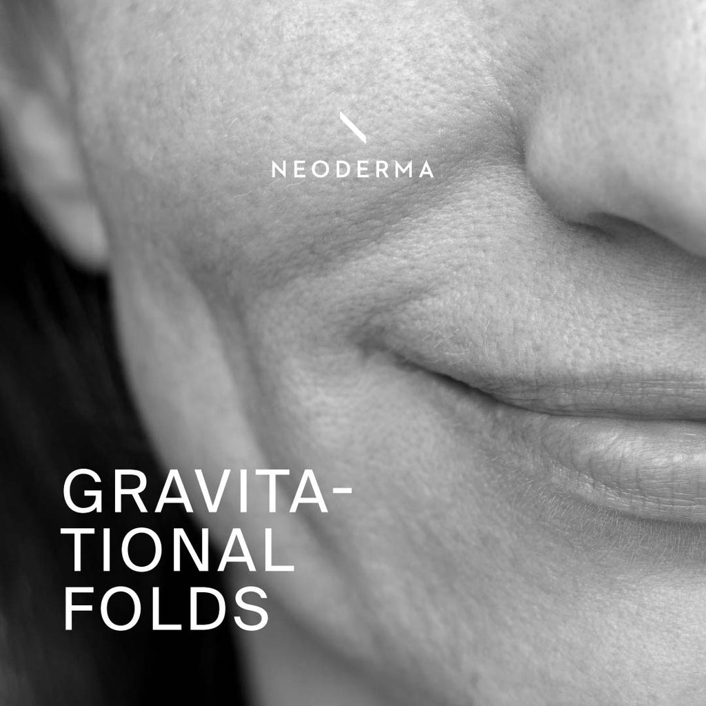 Gravitational Folds