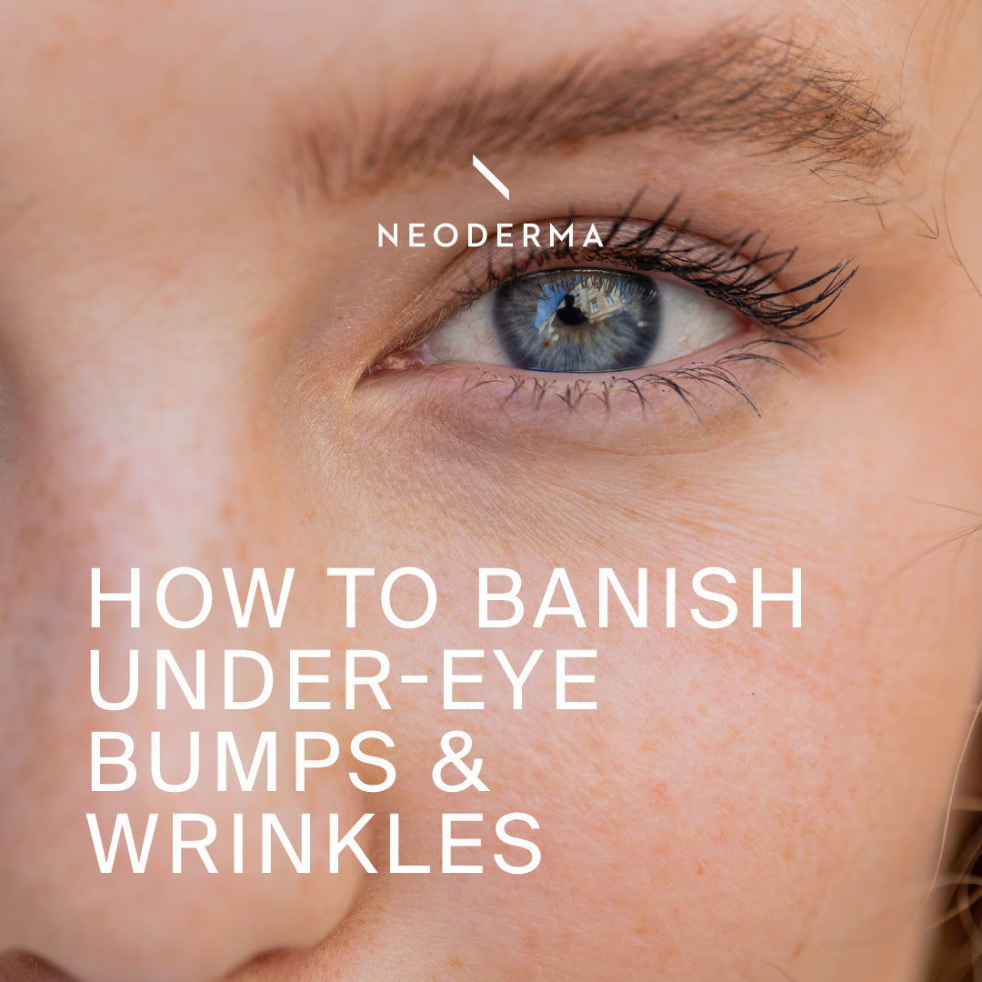 How to Banish Under-Eye Bumps and Wrinkles