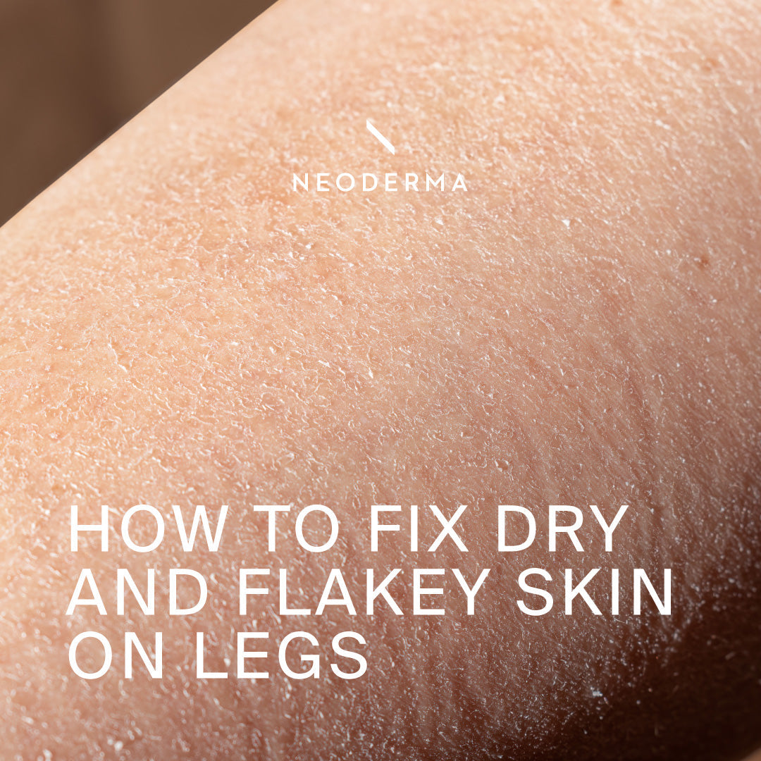 How to Fix Dry and Flakey Skin On Legs