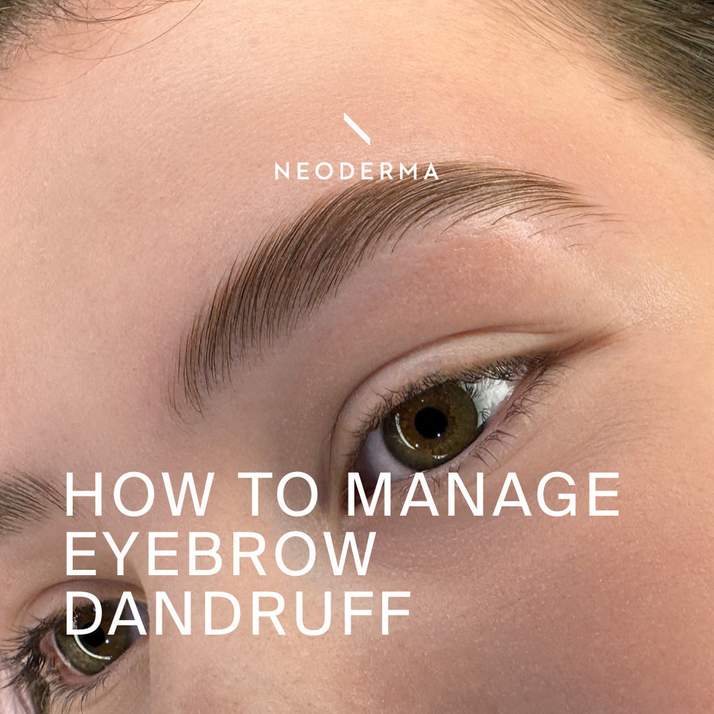 How to Manage Eyebrow Dandruff