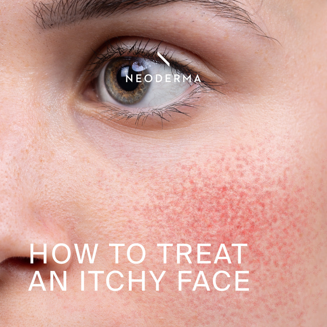 How to Treat an Itchy Face – NEODERMA