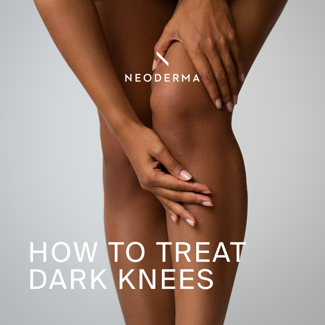How to Treat Dark Knees