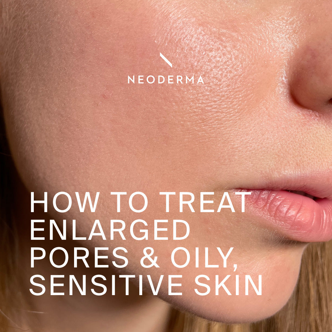 How To Treat Enlarged Pores And Oily, Sensitive Skin Without Making Things Worse