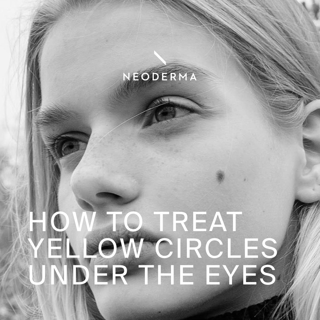 How to Treat Yellow Circles Under The Eyes