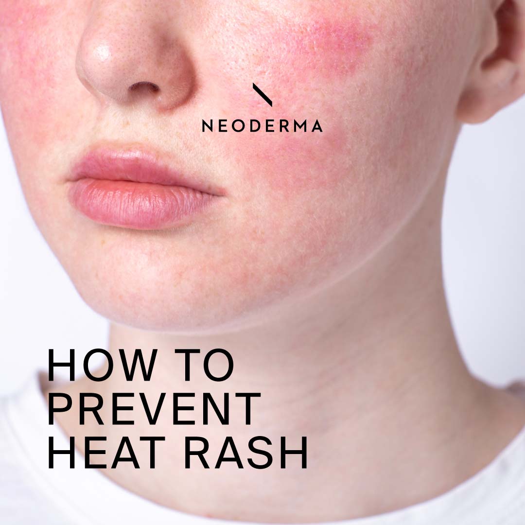 How to Prevent Heat Rush