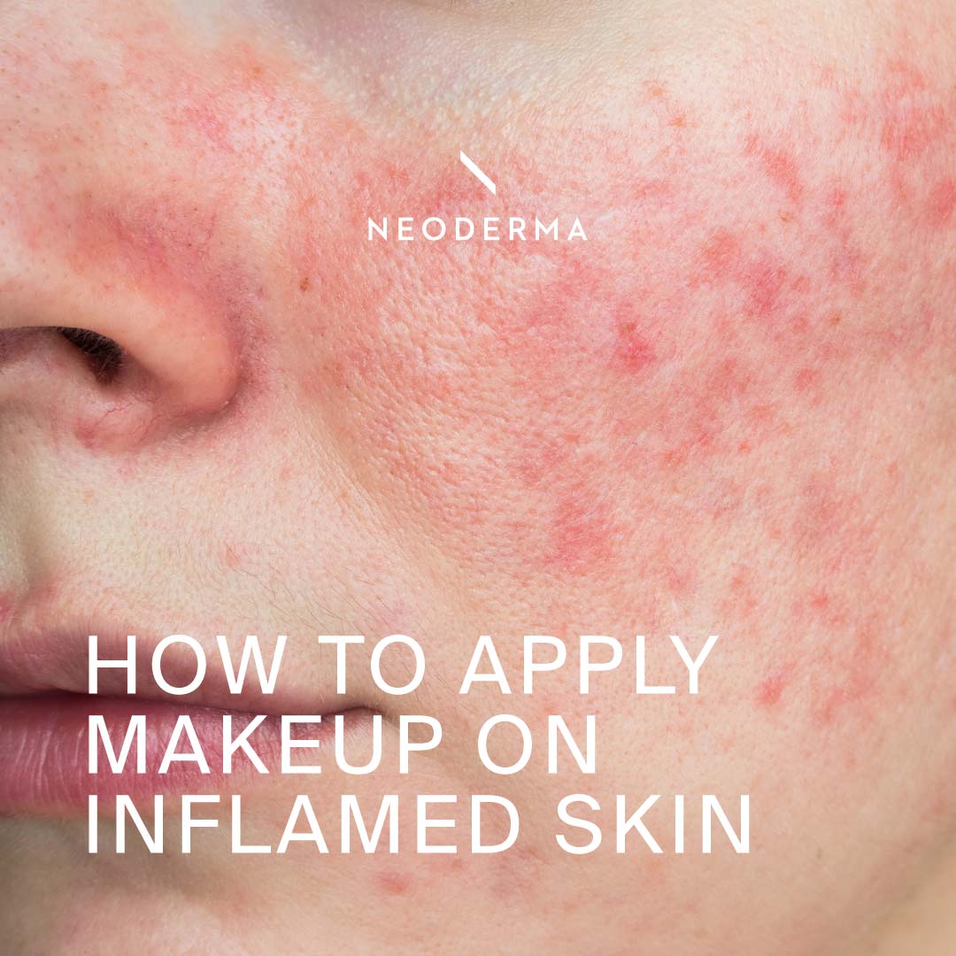 How to Apply Makeup on Inflamed Skin