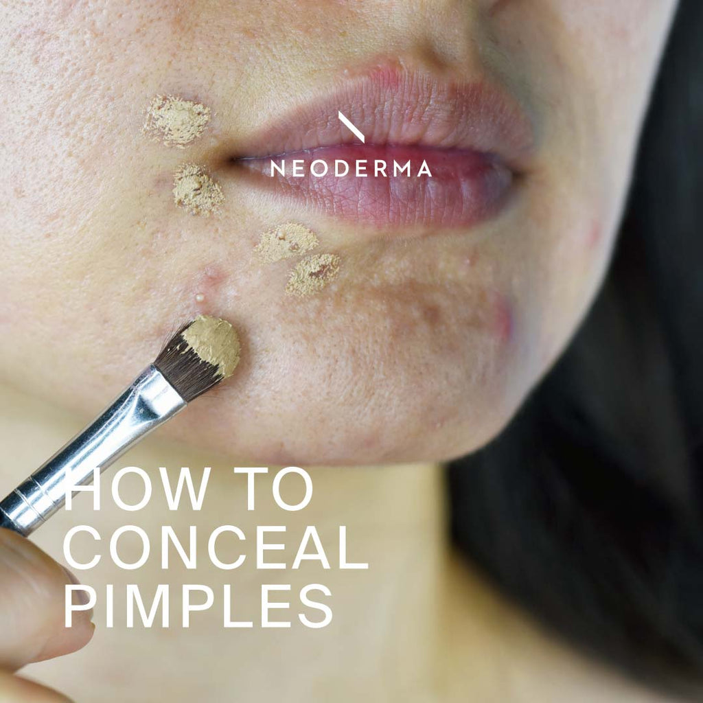 How to Conceal Pimples
