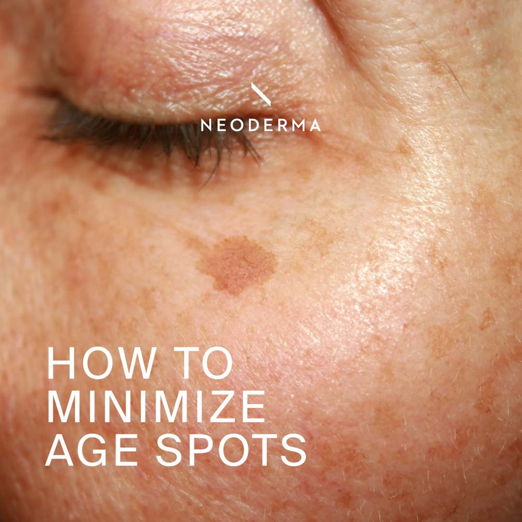 How to Minimize Age Spots