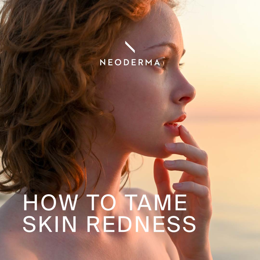 How to Tame Skin Redness