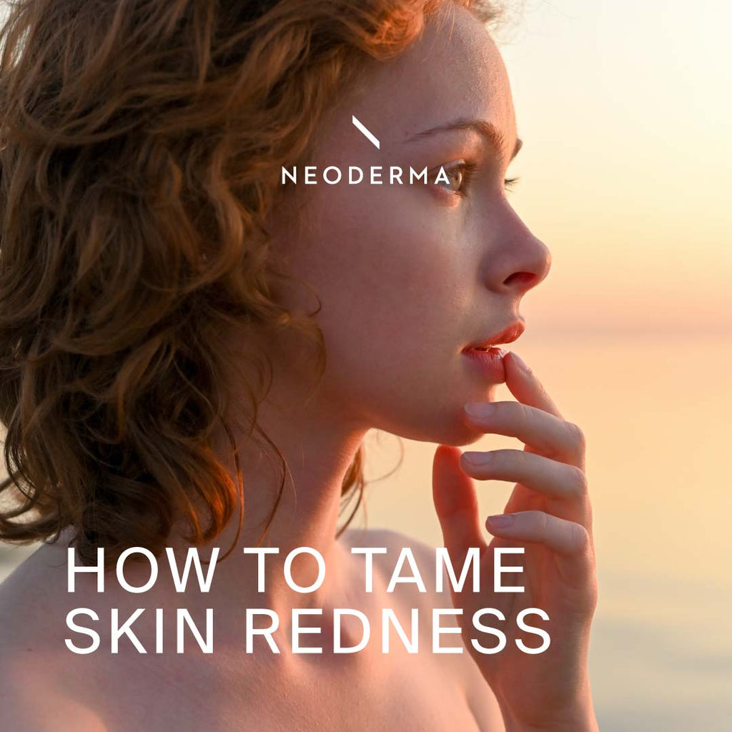 How to Tame Skin Redness