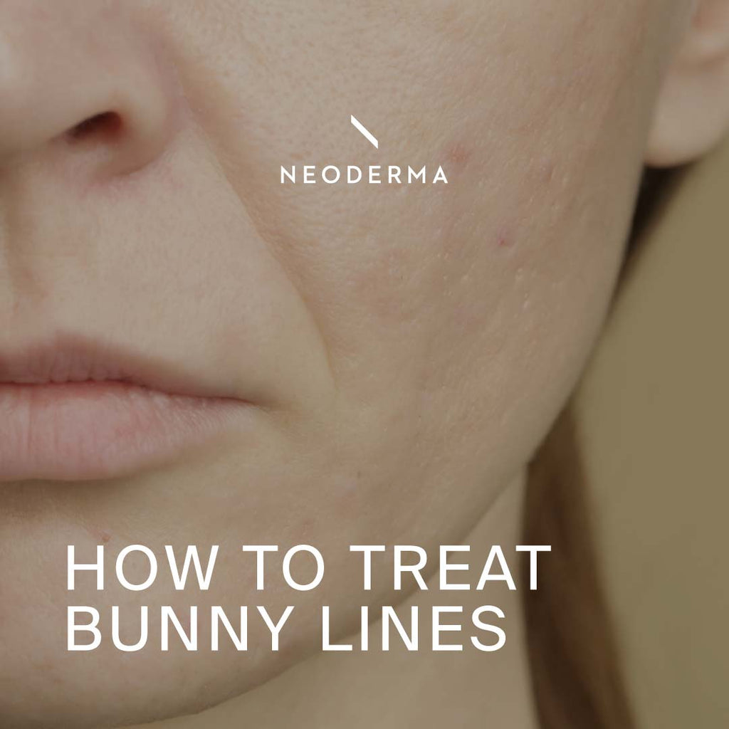 How to Treat Bunny Lines